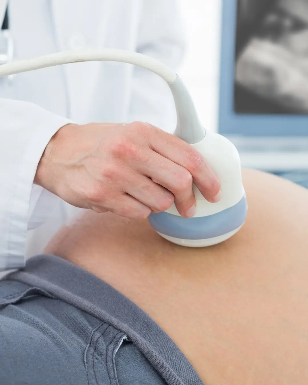 OMS alerta sobre mortes maternas e neonatais evitáveis e destaca avanços desde 2000