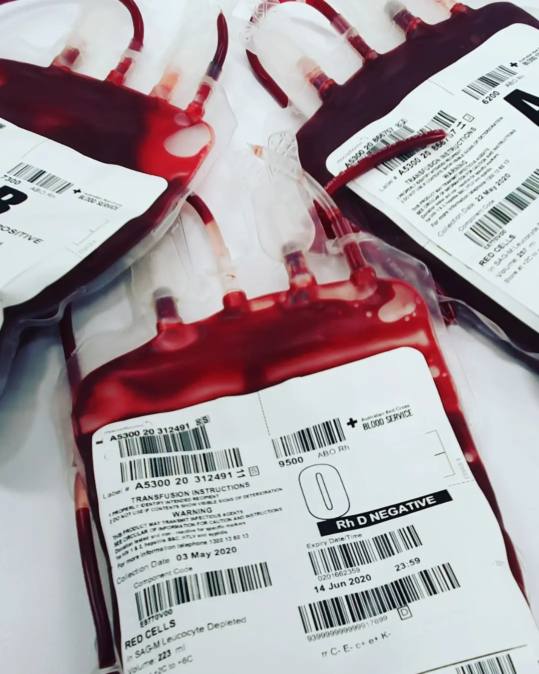 TJPR autoriza transfusão de sangue em bebê após recusa dos pais por religião