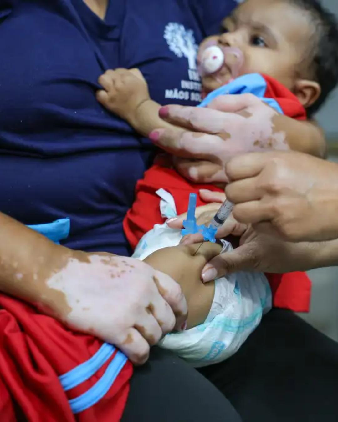Casos de coqueluche aumentam no Brasil, com internações e mortes registradas