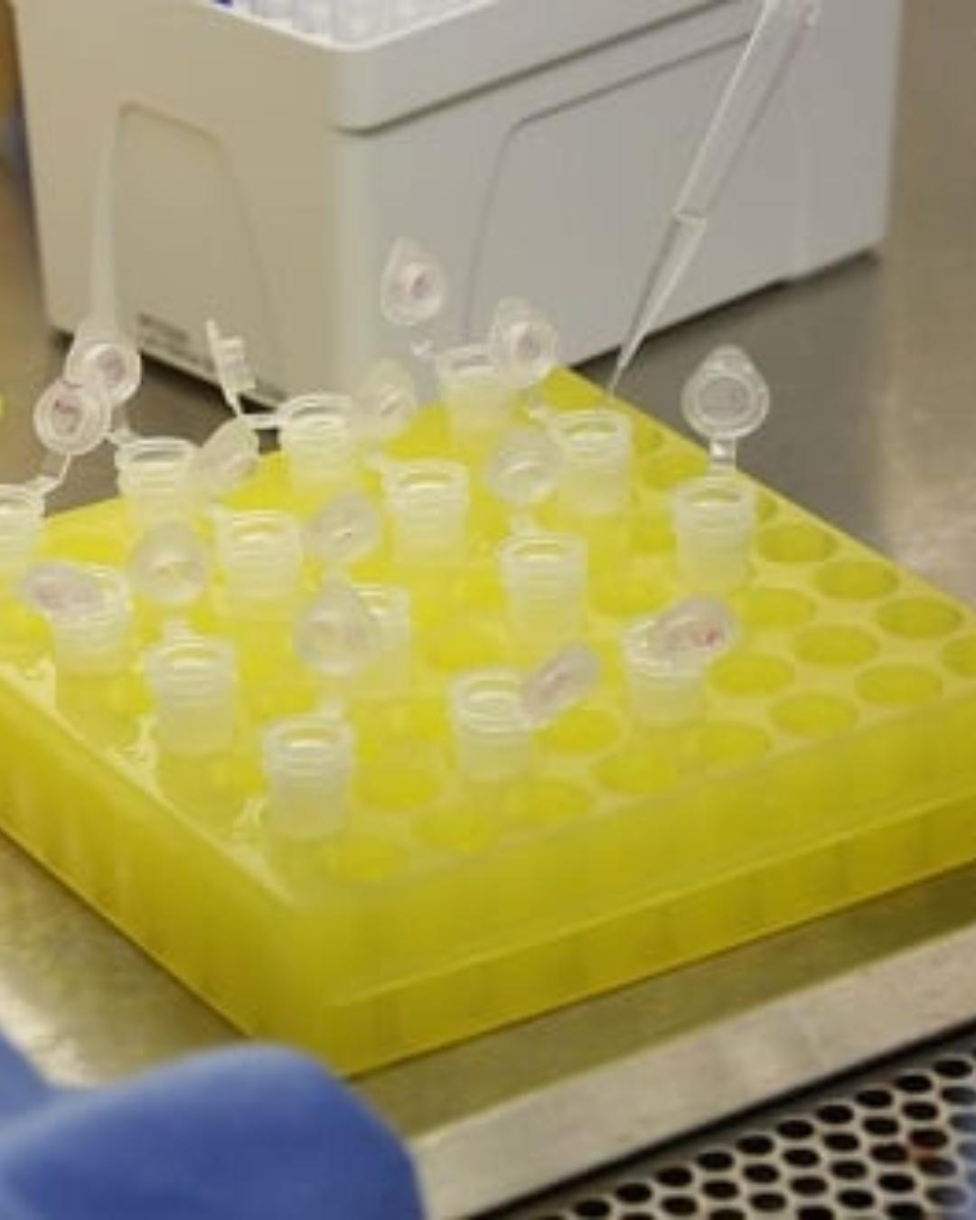 Casos de vírus sincicial respiratório e gripe disparam no Brasil em 2025, apontam especialistas