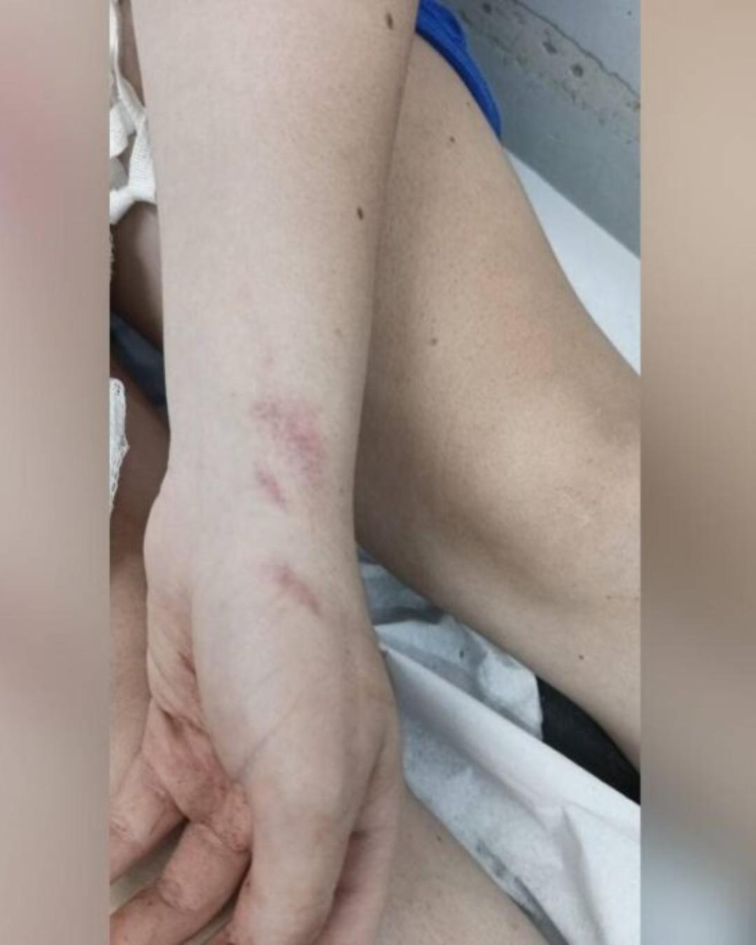 Adolescente de 16 anos agredida pelo namorado é socorrida e caso termina em prisão em Fazenda Rio Grande