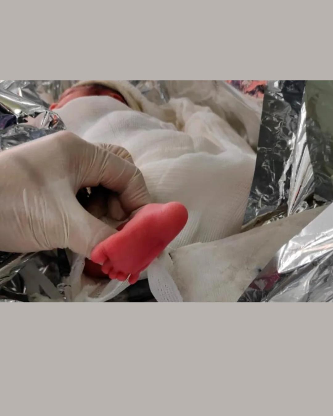 Bebê prematura é a primeira transportada em incubadora neonatal de helicóptero no Paraná