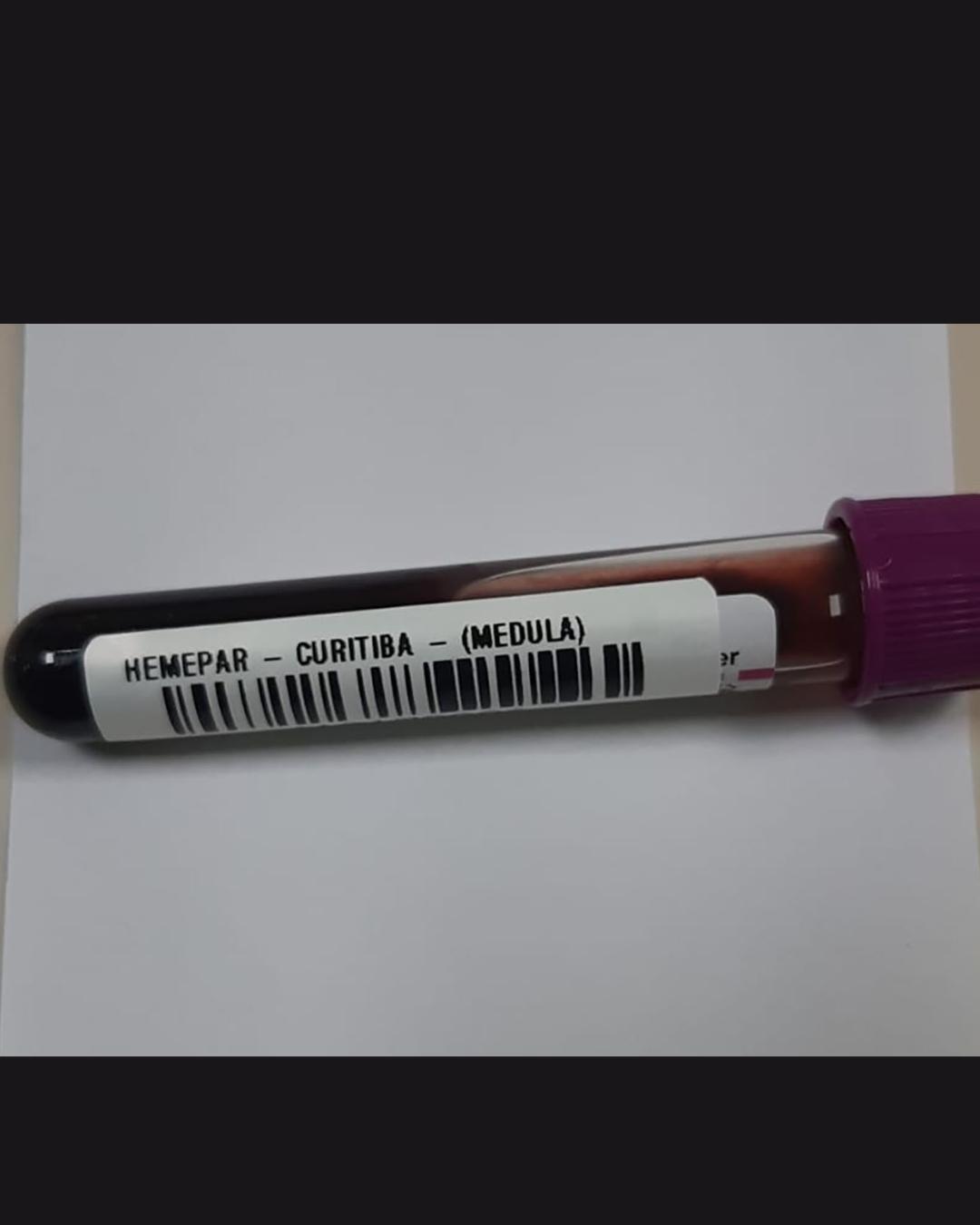 Conscientização sobre leucemia em fevereiro destaca sinais da doença e tratamentos disponíveis