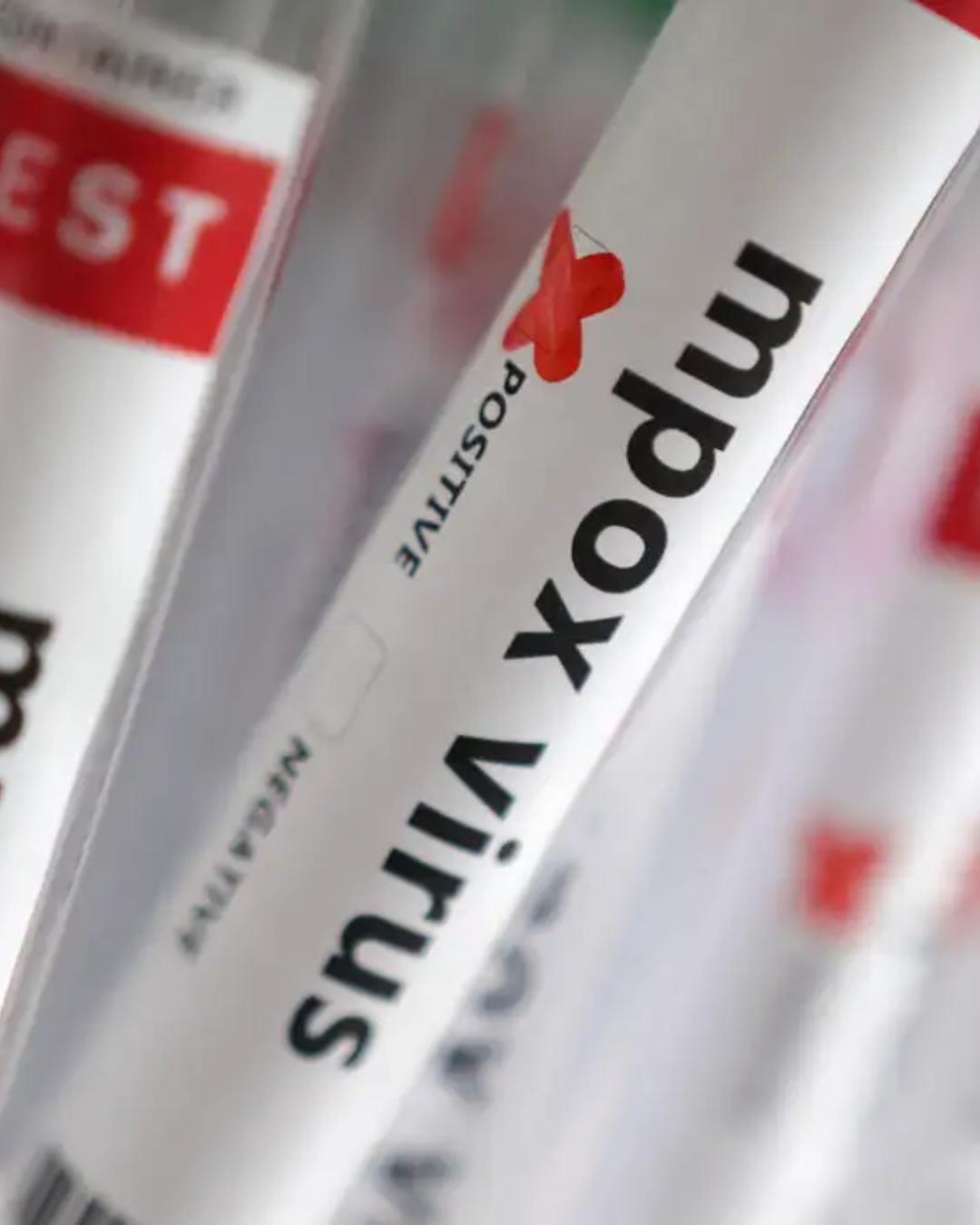 Casos de Mpox no Brasil chegam a 140 em 2026; São Paulo lidera registros