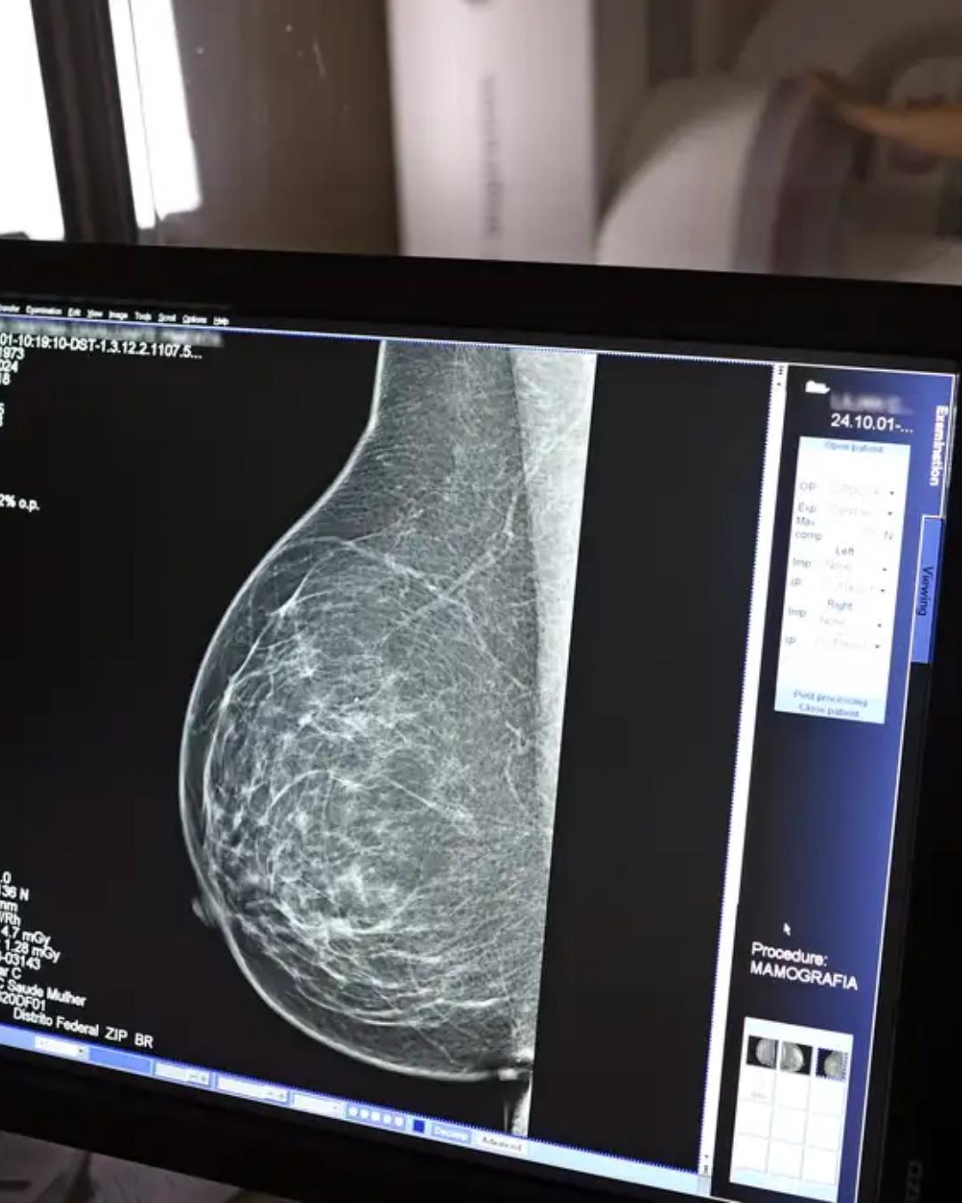 Lei reforça folgas anuais para exames preventivos e determina divulgação pelas empresas