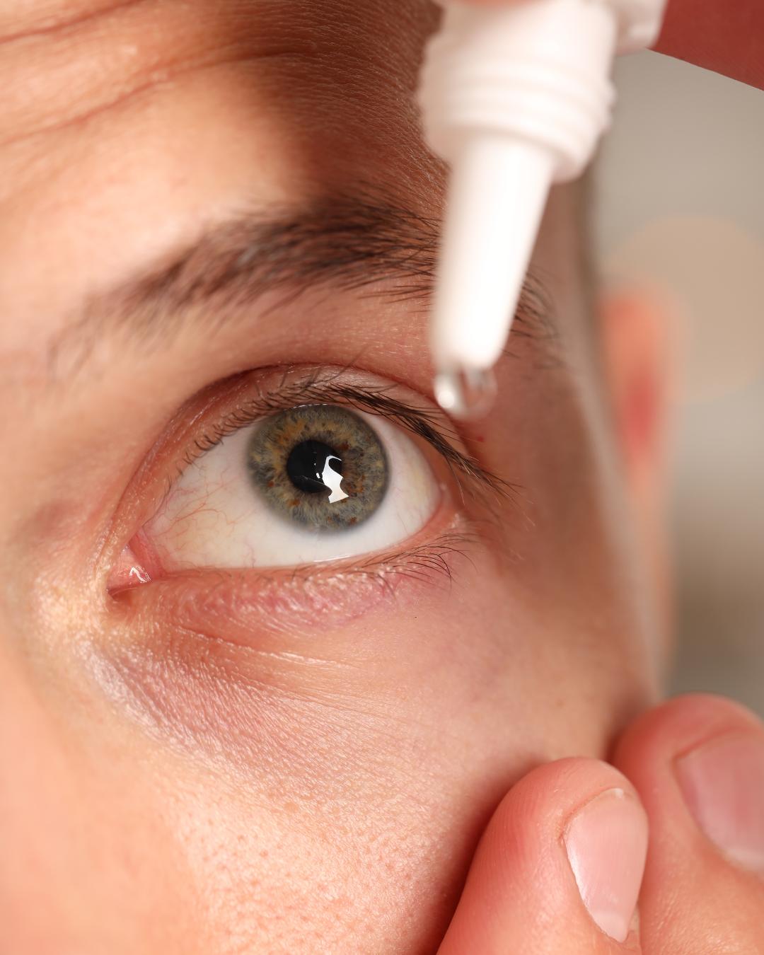 Entidades médicas alertam para risco de glaucoma causado por corticoides