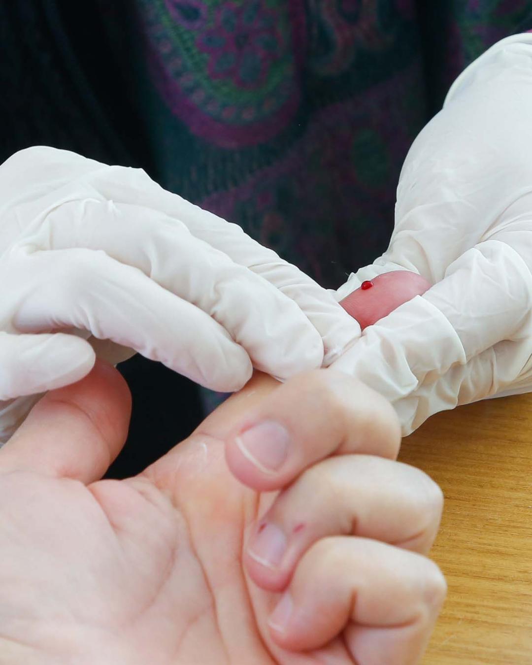 Paraná se destaca na redução da mortalidade por HIV e avanços na prevenção materno-infantil