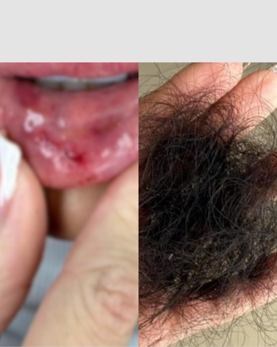 Justiça revoga prisão preventiva de suspeito de torturar dentista em Pinhais e determina condições restritivas