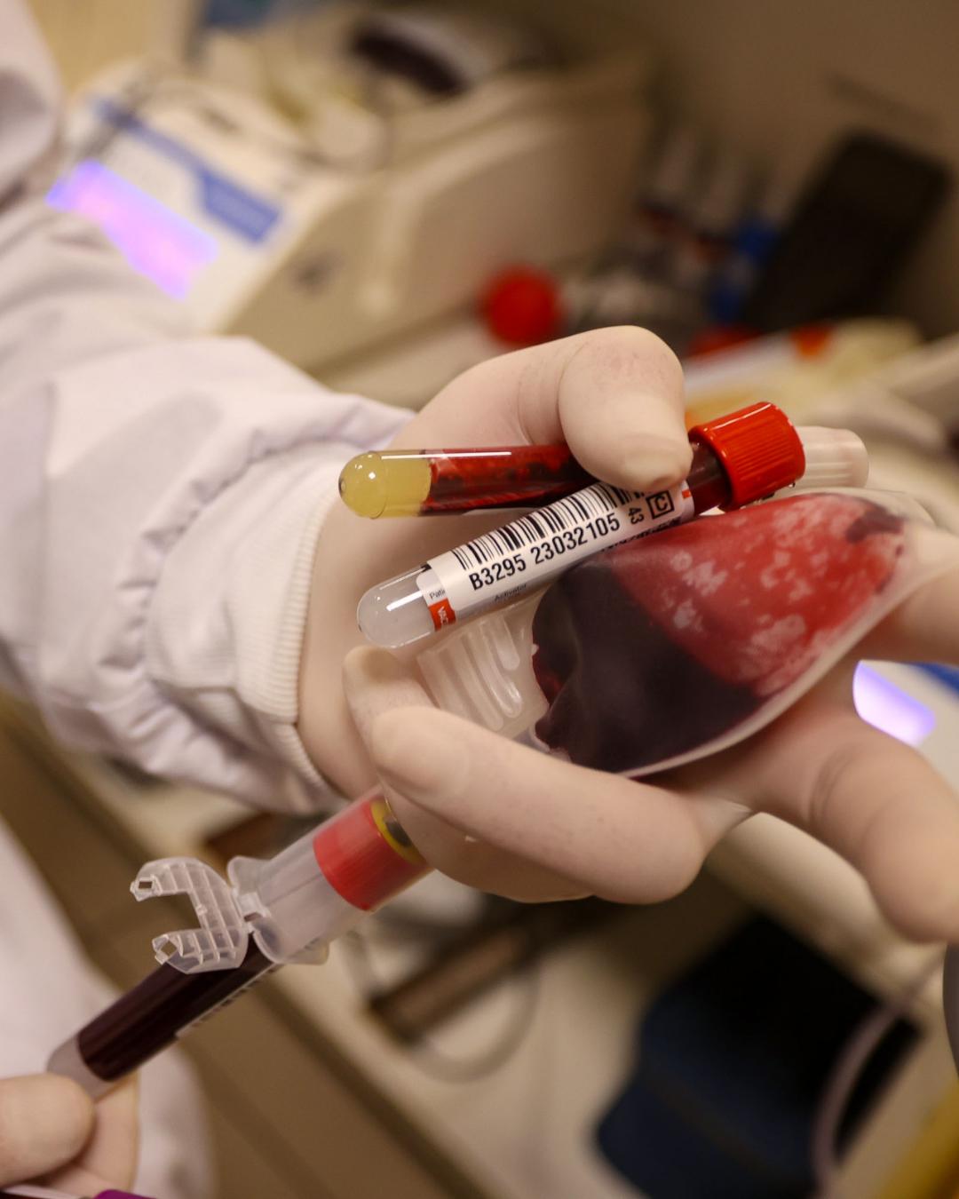 Hemepar alerta para baixa nos estoques de sangue e reforça importância de doações no estado do Paraná